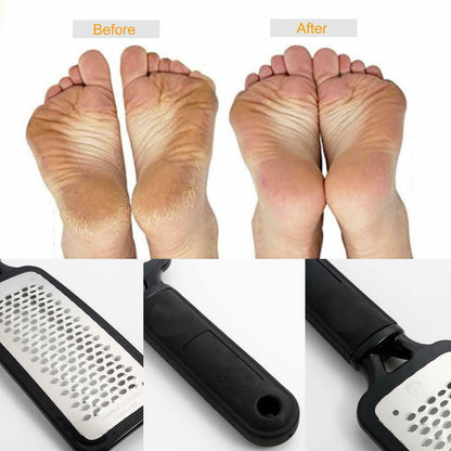 Foot Rasp File Callus Remover Pedicure Tool Dead Hard Skin Scraper Scrubber Tool