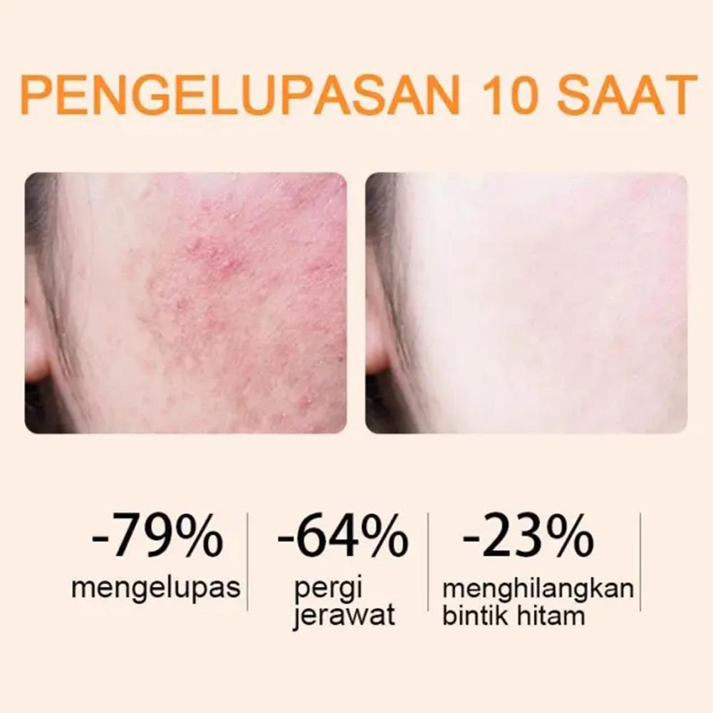 Skin Whitening Gel