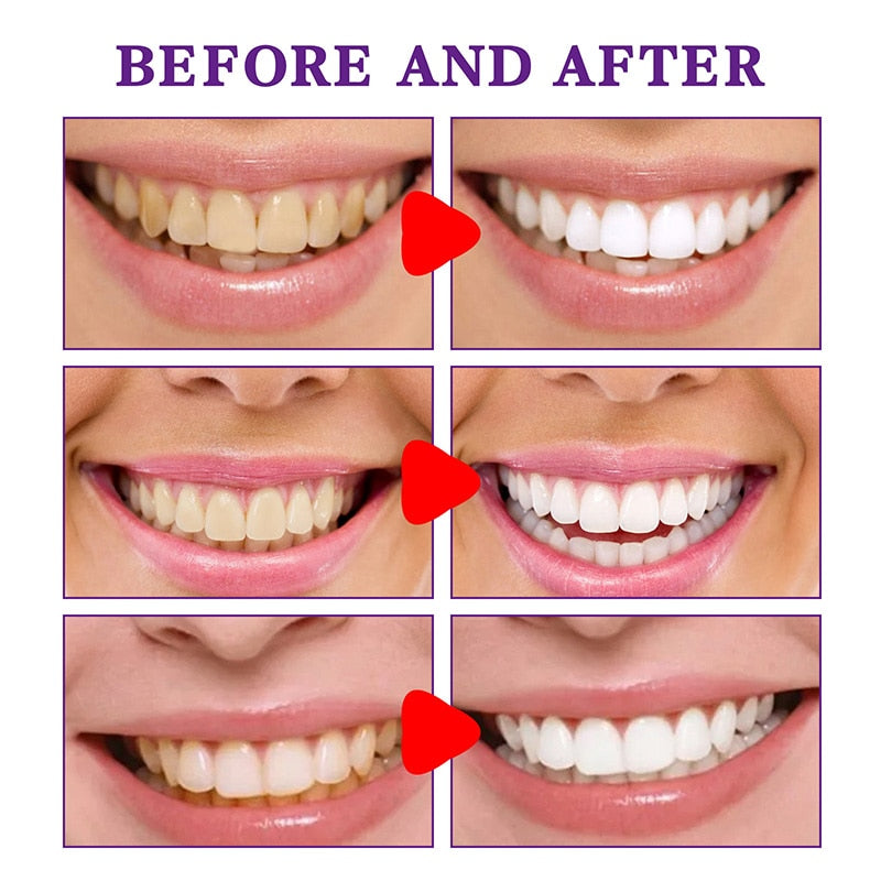 Purple Whitening Toothpaste