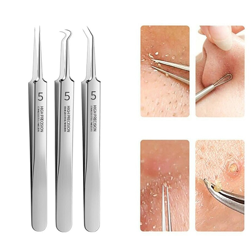 Pimples Blackhead Clip Tweezer