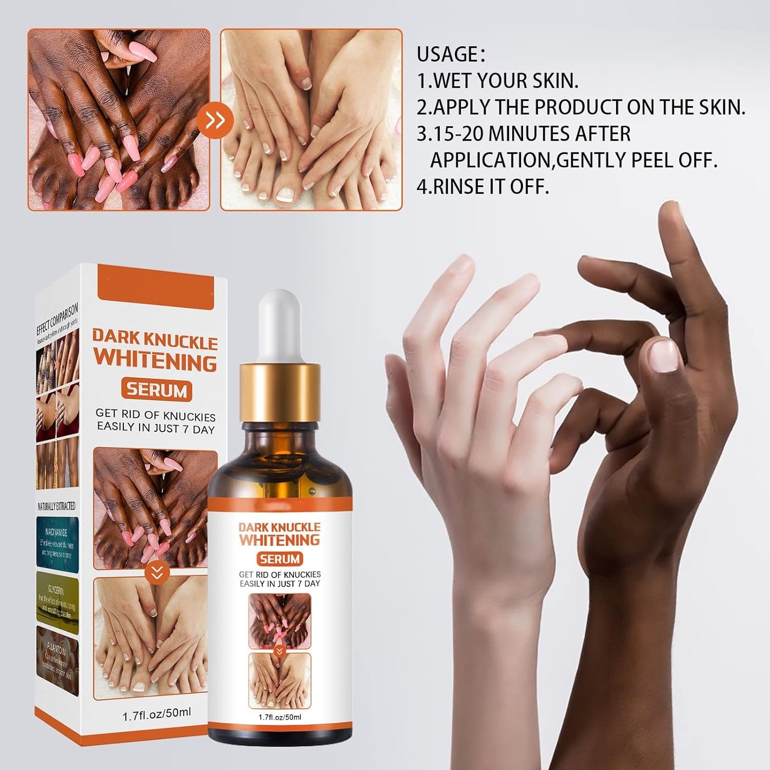 Acanthosis Nigricans Therapy Oil